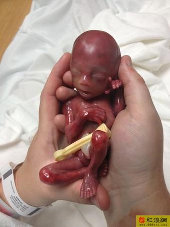美国印地安纳州一名妇人lexi在怀孕19周又3天时,肚子里的宝宝就无